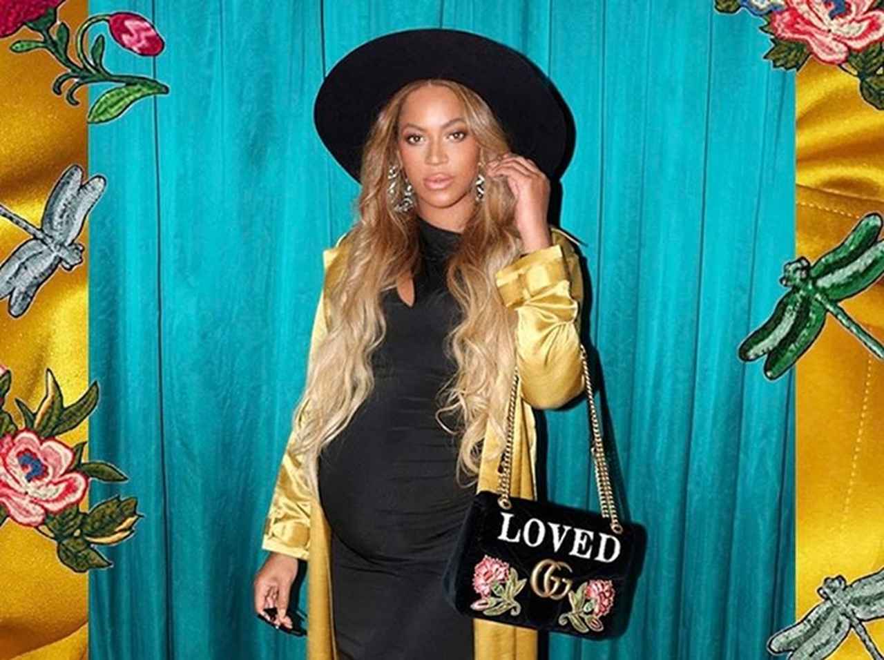 ビヨンセの唇は整形だと書きたてたメディアに代理人が怒り爆発