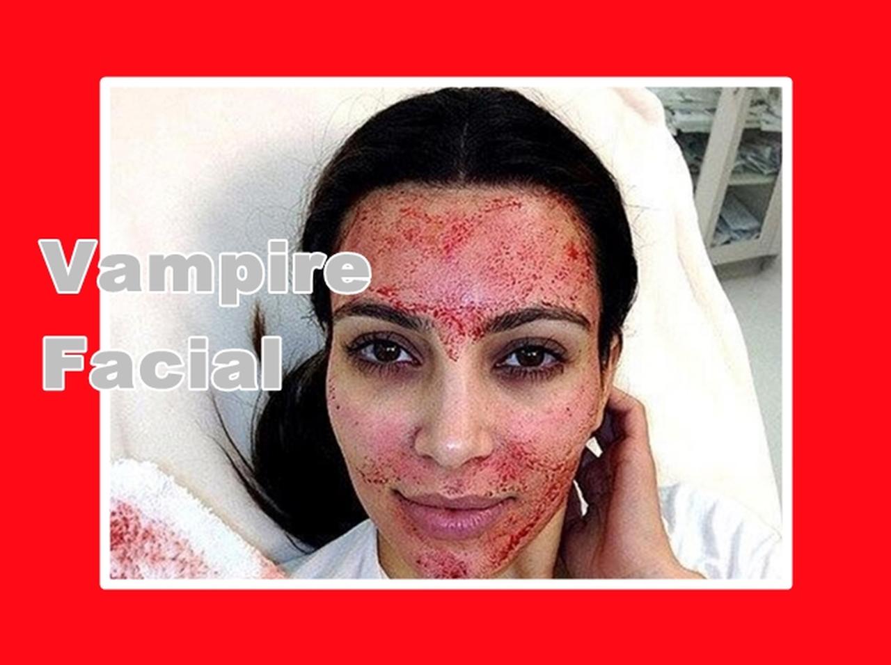 顔中血だらけになる最新美容法!キム・カーダシアンに続き姉も挑戦