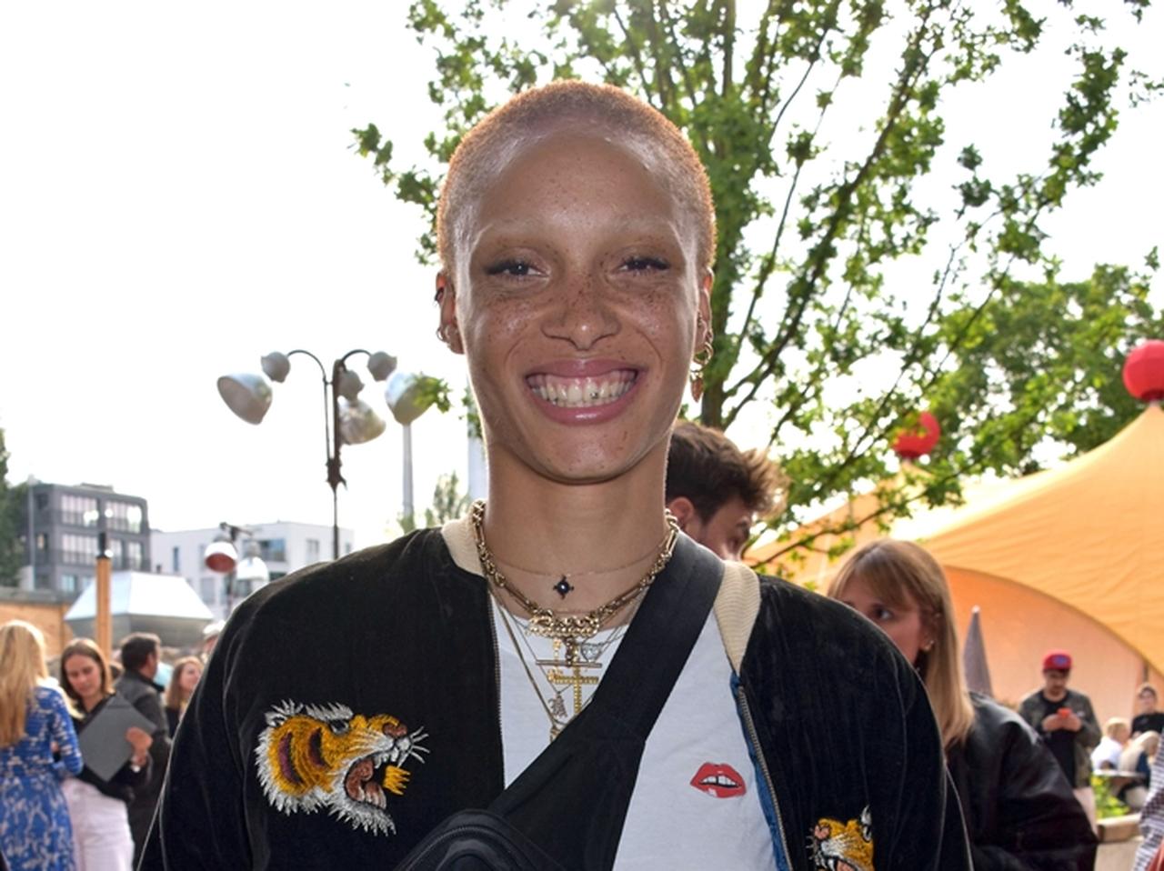 人気モデルのアジョワ・アボアー、路上でフォトセッションしている間に胸ポロ