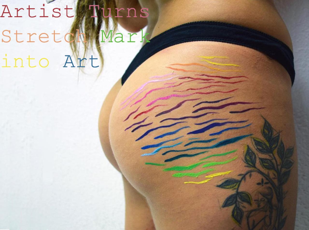「肉割れ線は醜くない!」ストレッチマークをカラフルに彩るアートが話題
