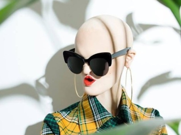 難病を抱えながらも個性を魅力に変えた注目モデル、メラニー・ゲイドス