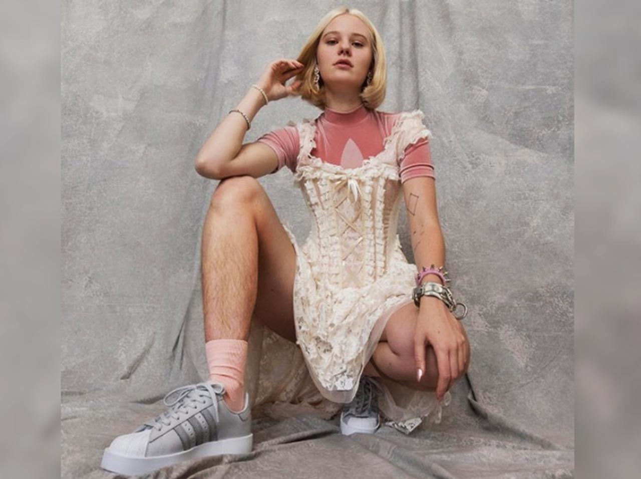 アディダスが「すね毛女子」をモデルに起用、多様性を表現