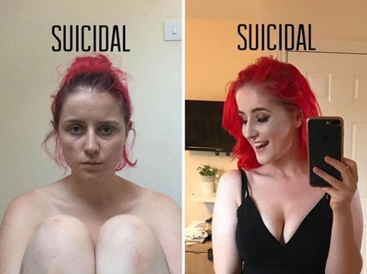 「自殺願望」があるかどうかは外見じゃわからない、ある女性が2枚の写真で証明