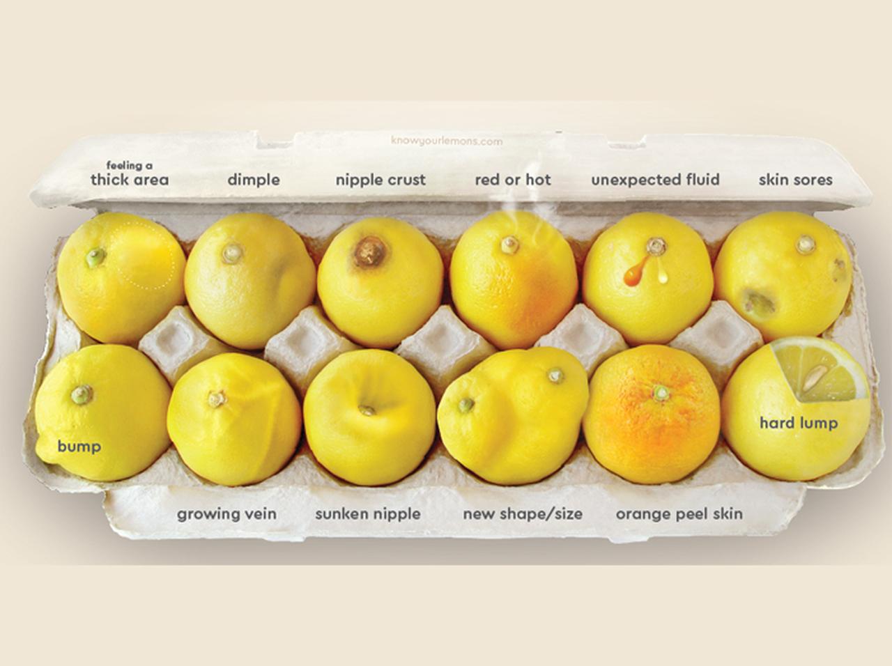 乳がんのサインを12個のレモンで表した写真が女性たちの命を救う