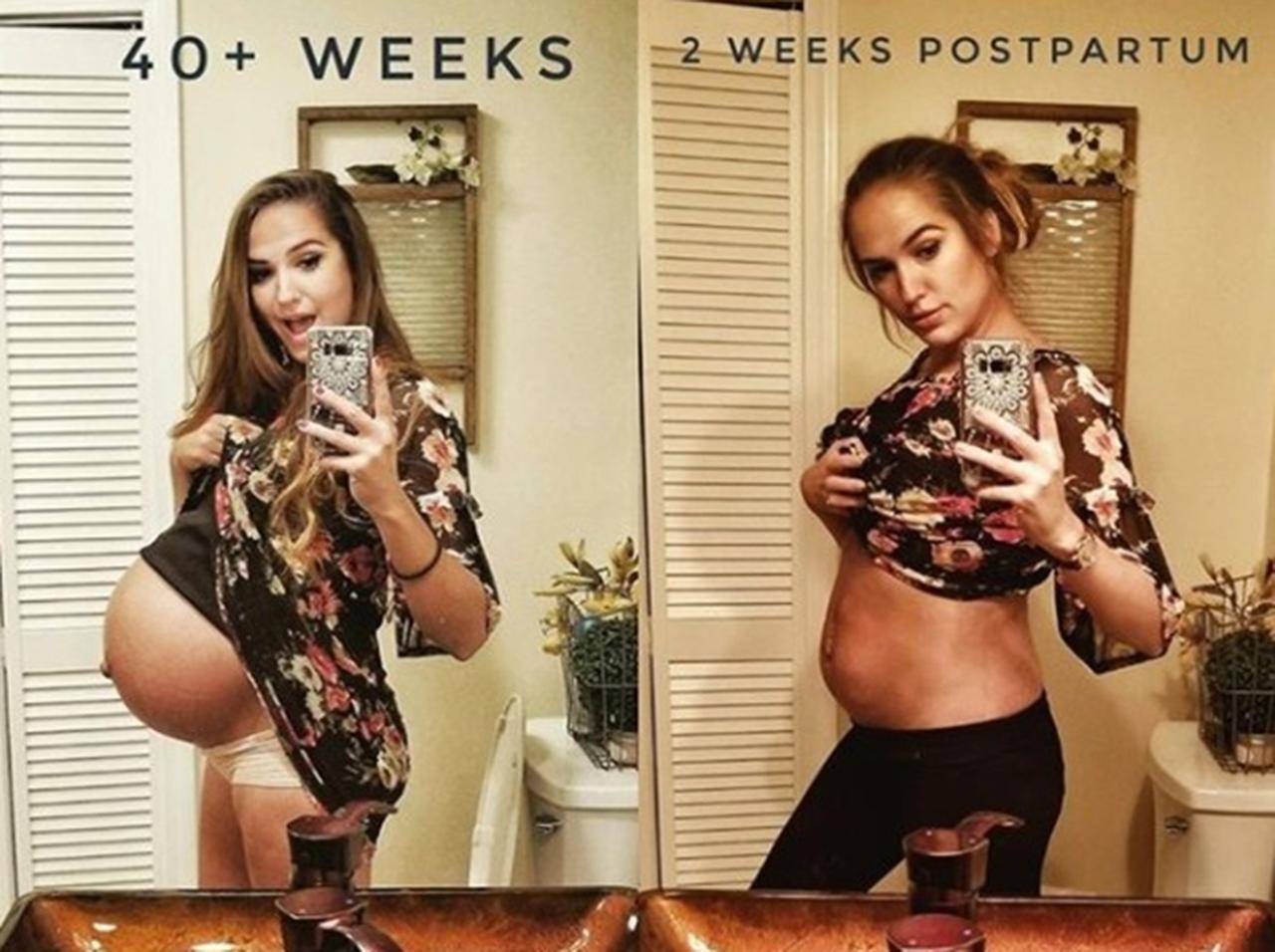 産後2週間の「ぽっこりお腹」を公開した女性に称賛の声