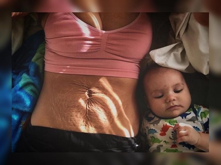 2児の母が産後の「体の変化」を写した写真を公開して大絶賛