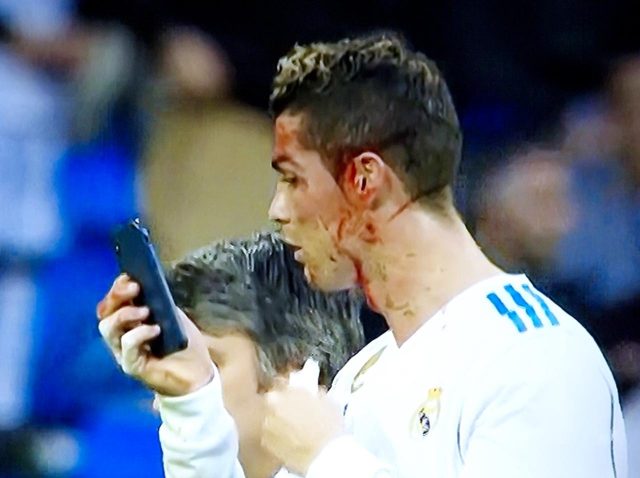 クリスティアーノ・ロナウド、ピッチ上で血まみれの顔をスマホで確認