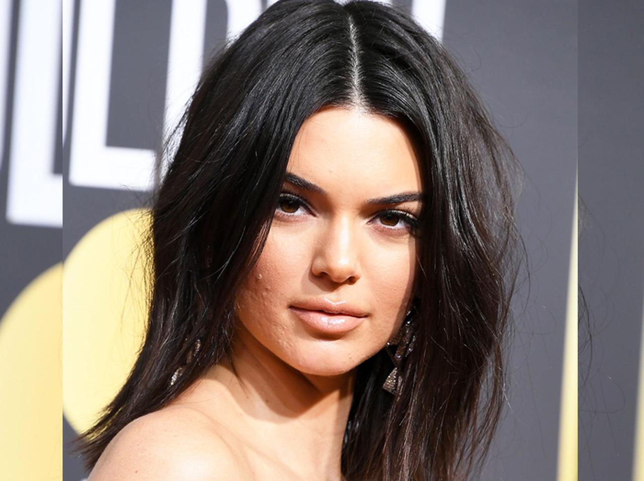 ニキビ肌を嘲笑されたケンダル・ジェンナー、「力強いひと言」で圧倒