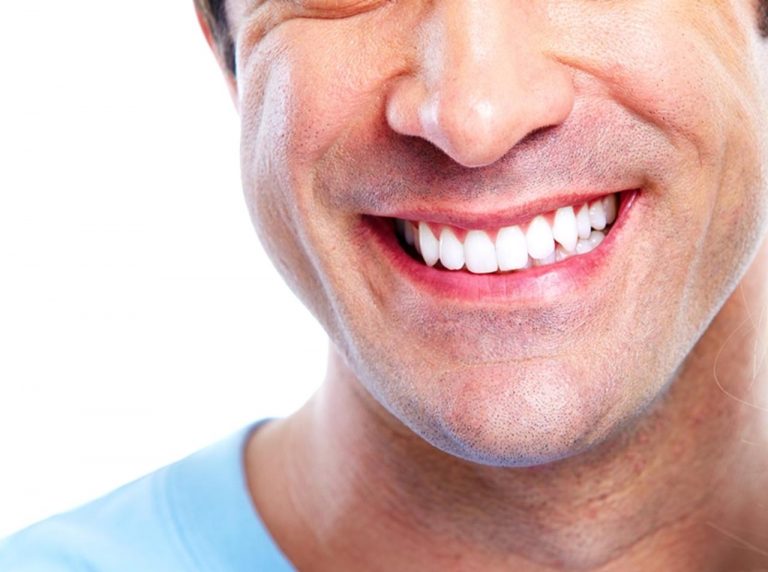 42ポンドで買った歯、笑劇的な結果に