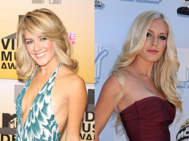 1度に10カ所の整形手術で「数分間死んだ」、人気セレブが語る整形の恐さ