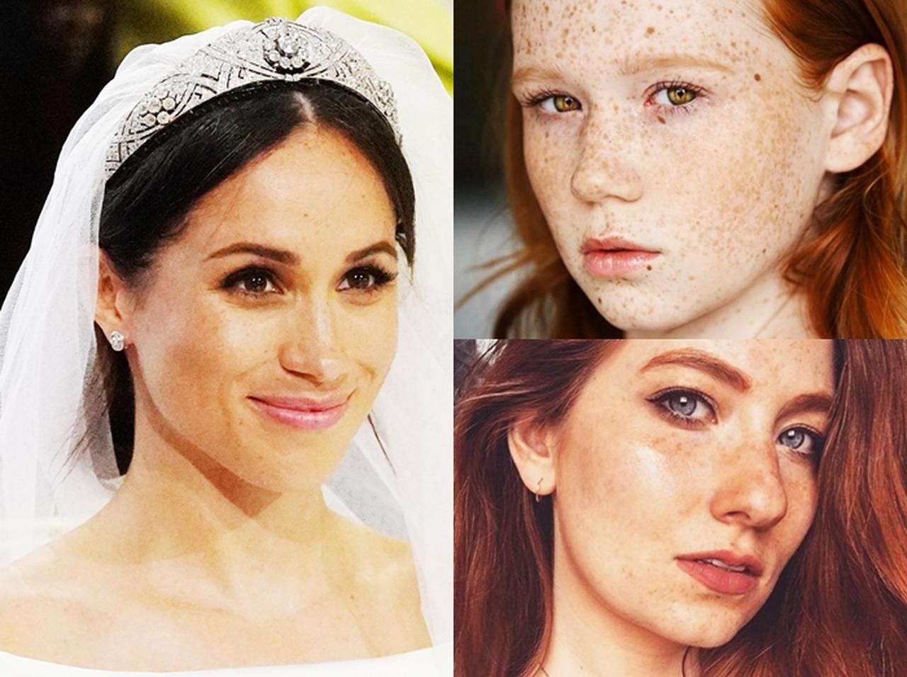 メーガン妃効果! SNSで「そばかす」セルフィーを披露する女性が急増中