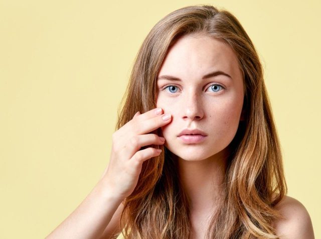 ニキビの場所で原因が分かる？専門医が教える「フェイスマップ」