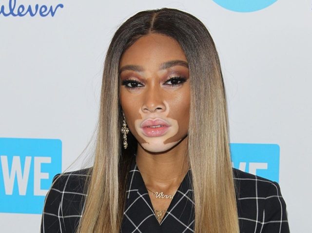 ウィニー・ハーロウ、日本の「金繕い」文化に感銘を受ける