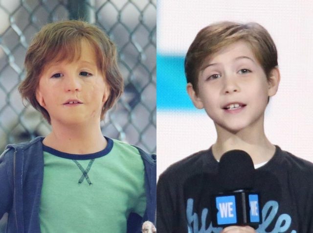 『ワンダー 君は太陽』で別人！天才子役J・トレンプレインの特殊メイクのこだわり