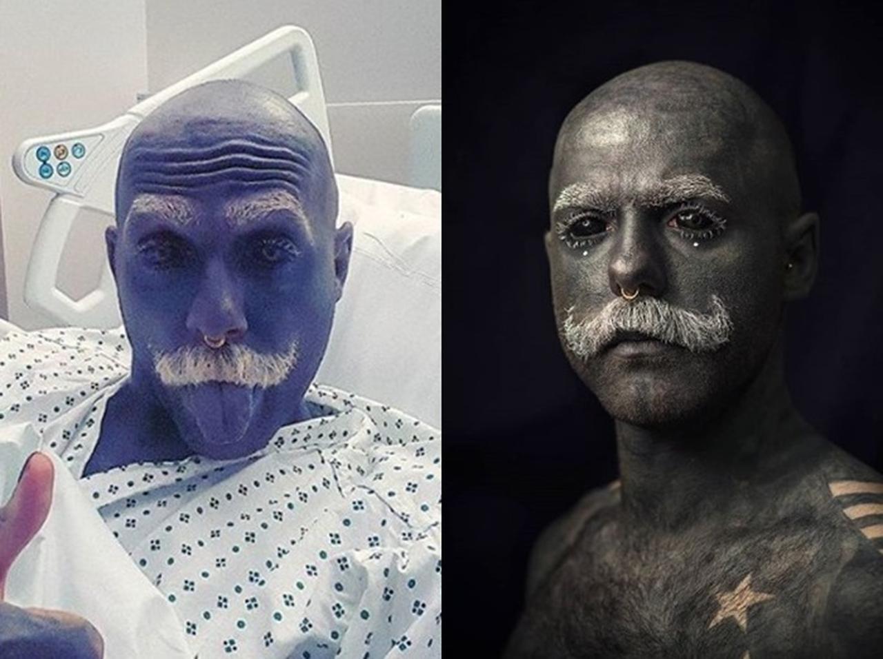 体の90%にタトゥーを入れた男性が「男性器」を切除、しかし悲劇の結果が…