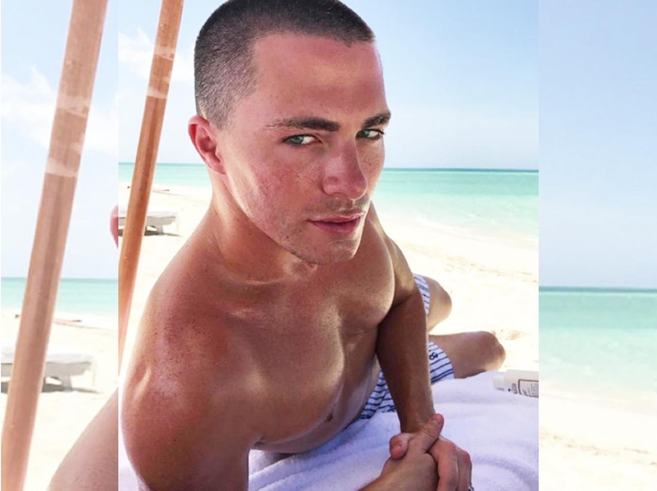 ソフトマッチョ俳優コルトン・ヘインズの「うっかり日焼け」が閲覧注意レベル