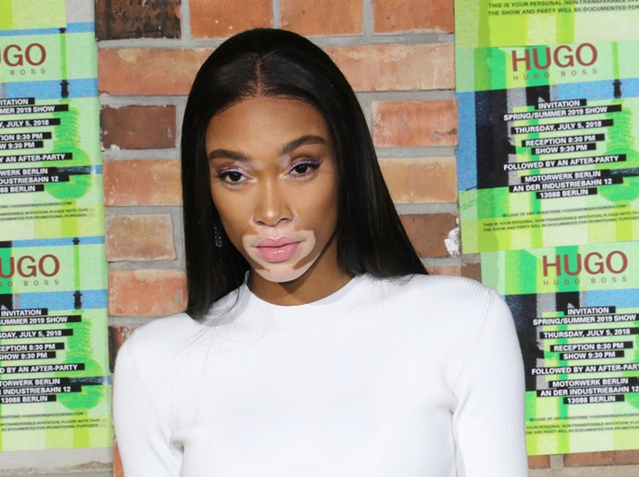 ウィニー・ハーロウ、自分に関しての記事を自ら添削！その「訂正箇所」に親近感