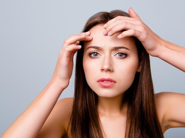 プロのメイクが伝授！メイクで上手にニキビを隠す方法とは？