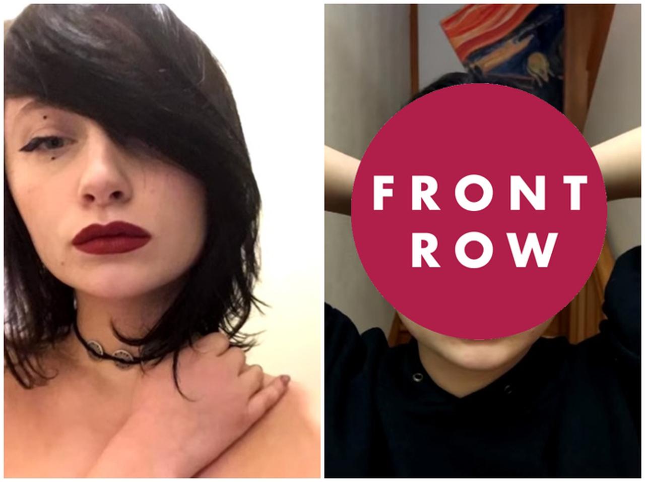 市販のヘアカラー剤を使った女性、頭が「電球」のように腫れ上がる