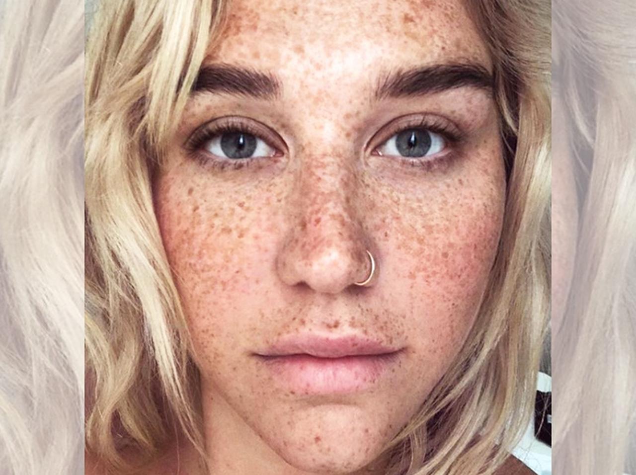 ケシャ、「そばかす」だらけの顔を晒して宣言した“今年の抱負”に喝采