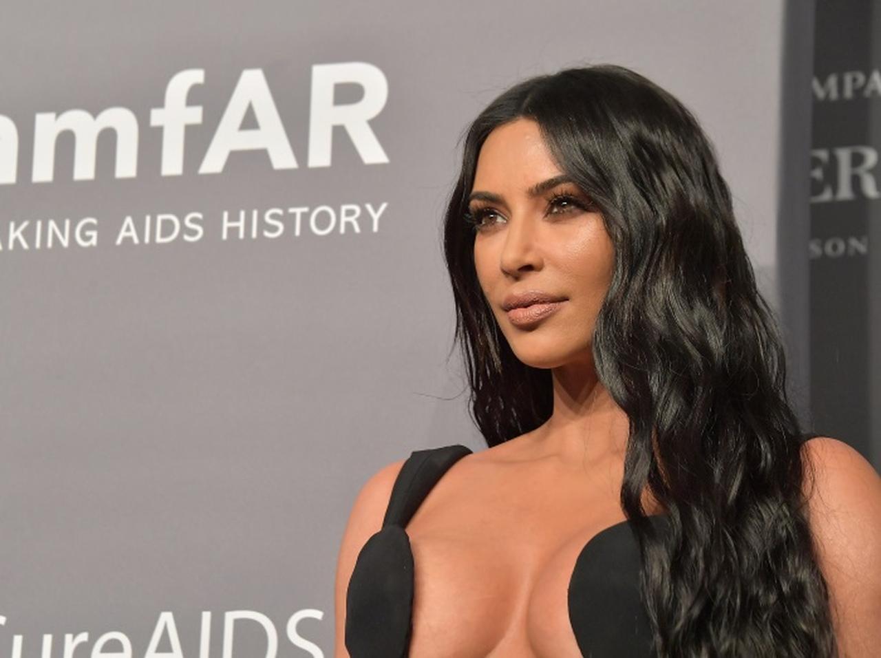 キム・カーダシアン、皮膚の病気「乾癬」の写真を公開