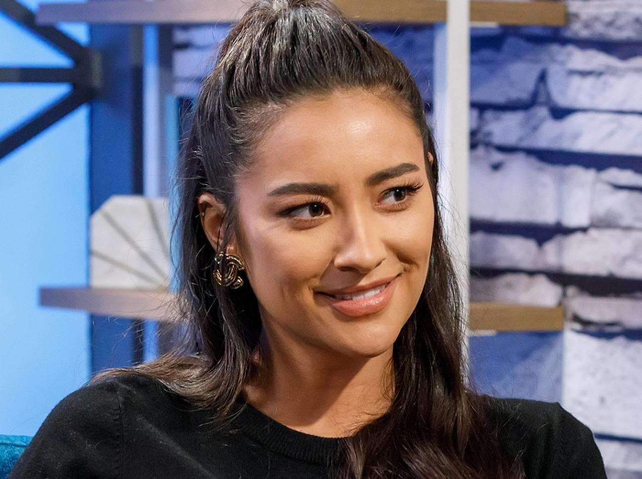 シェイ・ミッチェル、「ある行為」のせいで歯を失ってしまい「歯抜け美女姿」を公開