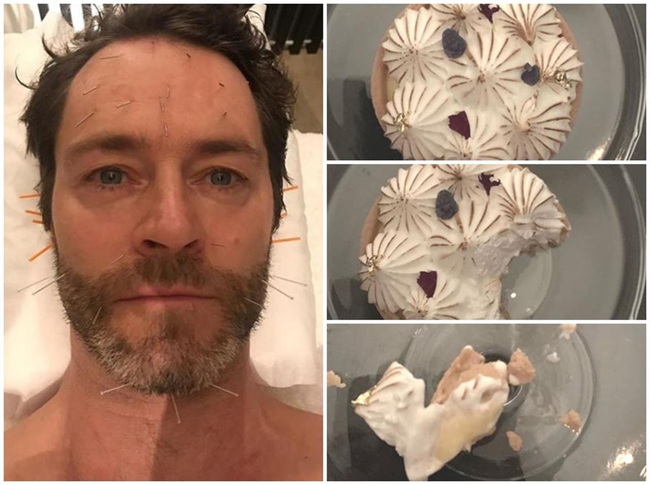 元アイドル、レモンパイやおやつをドカ食いして、涙目で顔にハリ…