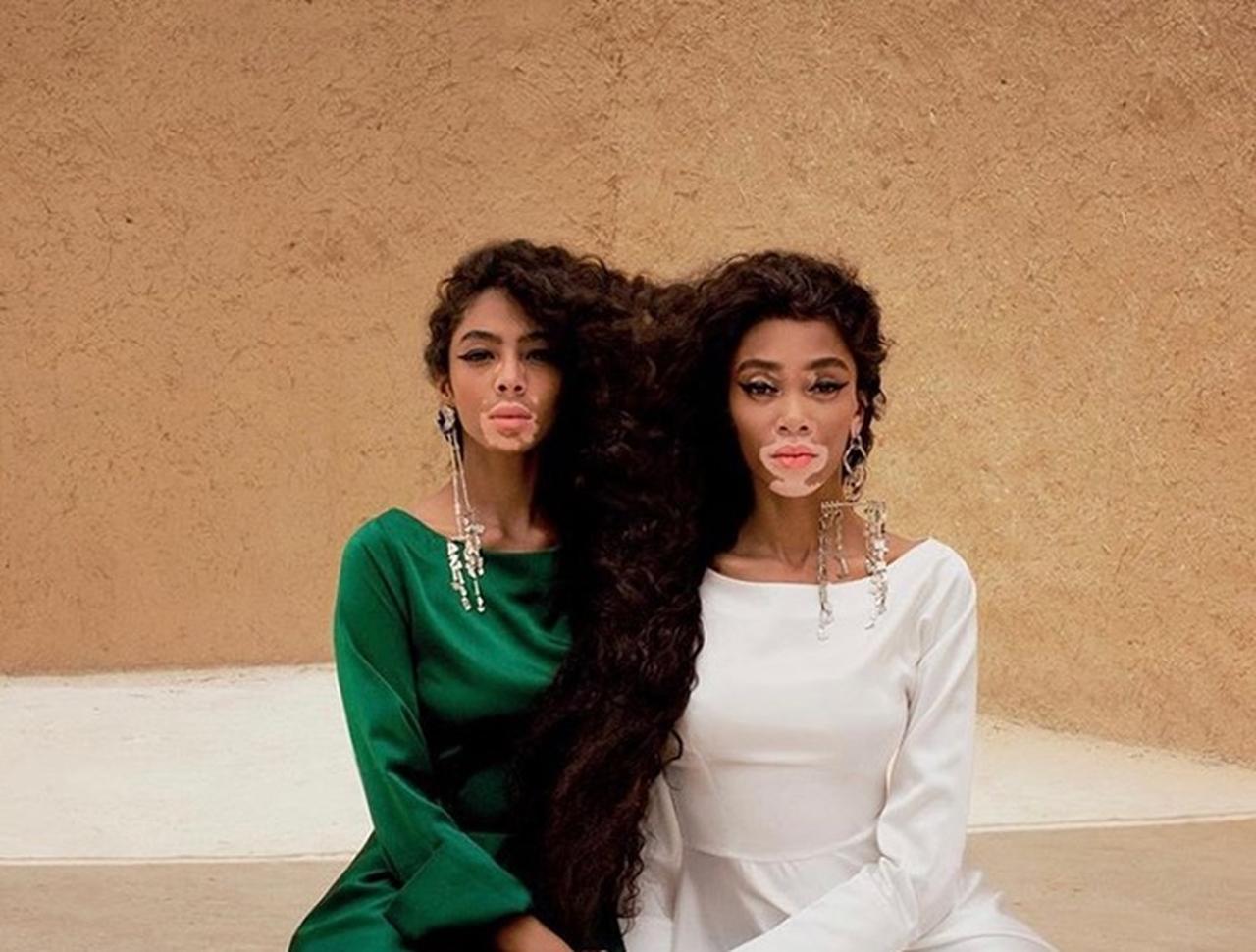 ウィニー・ハーロウ、ドッペルゲンガー並みにそっくりなモデルと表紙を飾る