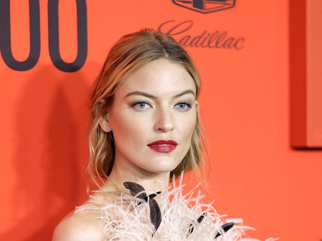 ヴィクシーエンジェルのマーサ・ハント、トップレス写真に写る大きな傷跡の正体