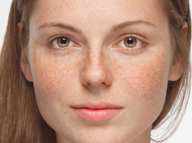 キュートな外国人風「そばかす」メイクをナチュラルに仕上げる方法