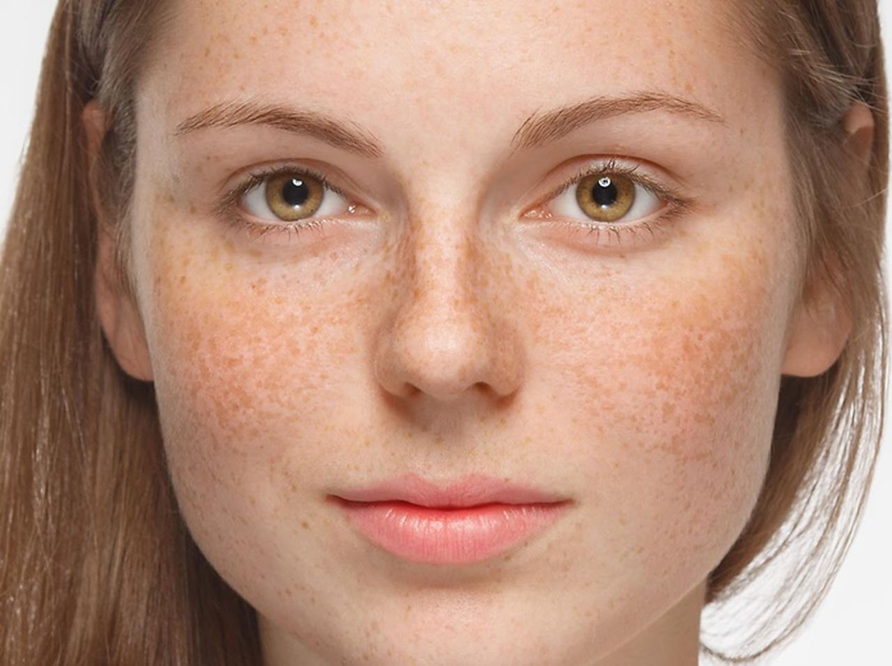 キュートな外国人風「そばかす」メイクをナチュラルに仕上げる方法