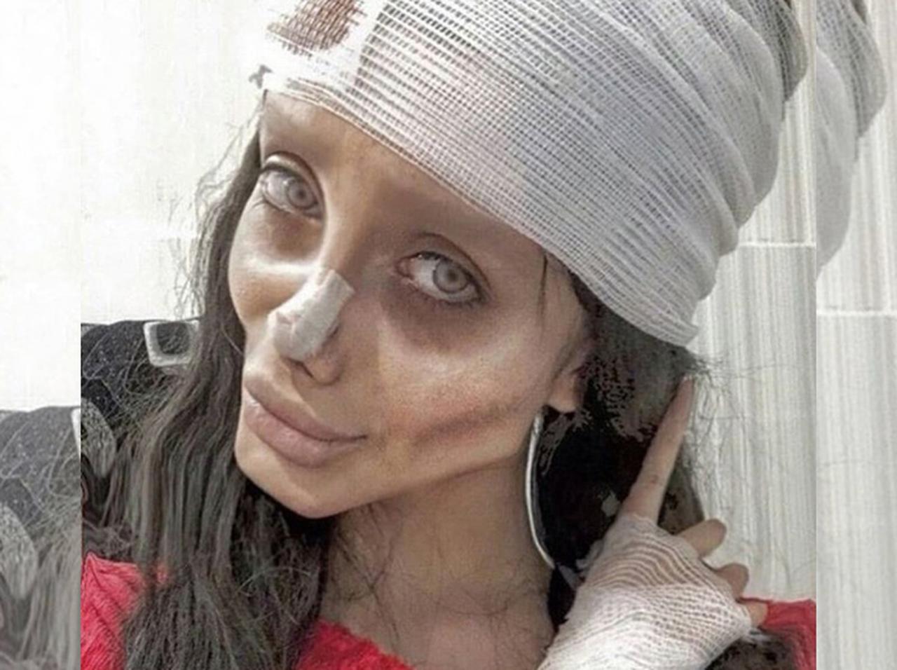 アンジェリーナ・ジョリーに憧れて50回以上の整形手術を受けた女性が逮捕