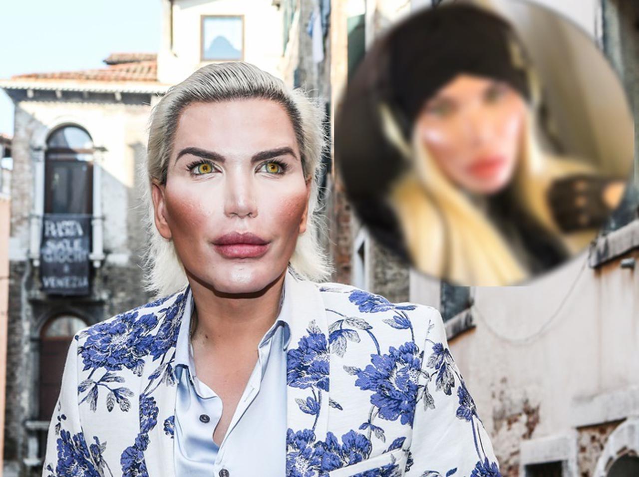 「リアルケン」から「リアルバービー」に…整形マニアが求めた究極は『女性』だった