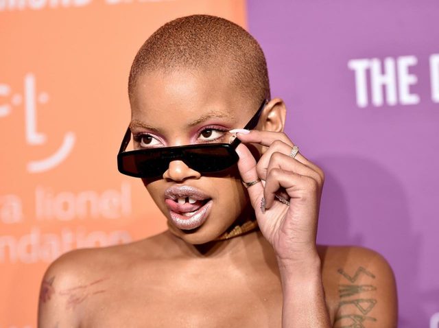 個性派モデルのスリック・ウッズ、「ステージ3の癌」で顔が腫れる