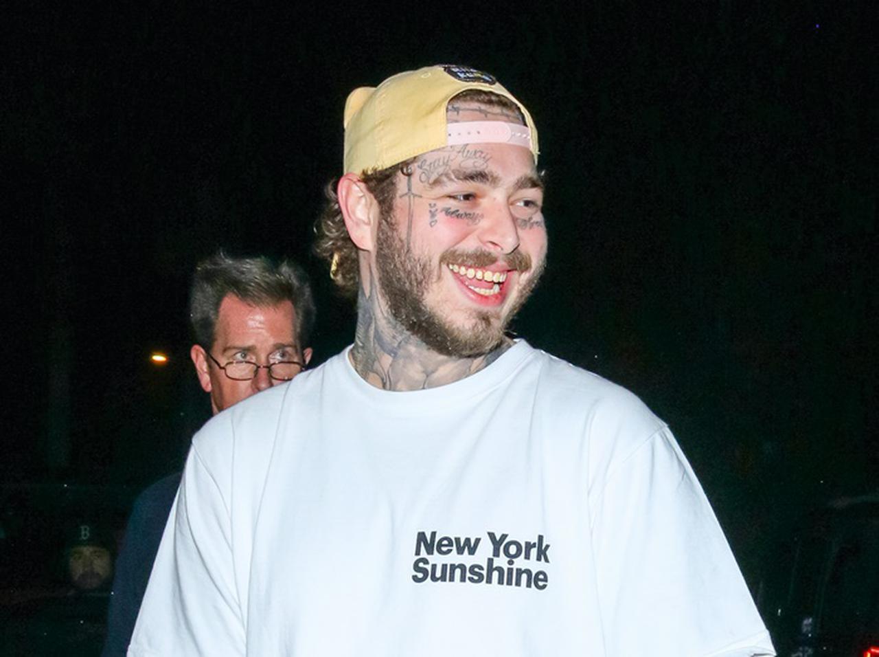 ポスト・マローン、血が滴り落ちる「顔面タトゥー」が痛々しい