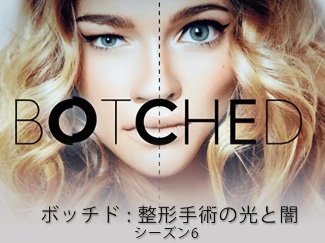 美容整形の失敗者を救済！『ボッチド：整形手術の光と闇 シーズン6』dTVで配信スタート