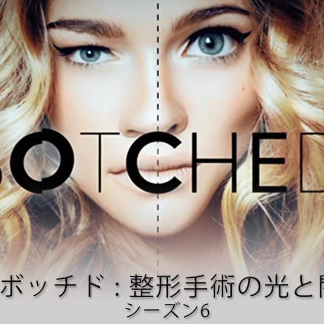 美容整形の失敗者を救済！『ボッチド：整形手術の光と闇 シーズン6』dTVで配信スタート