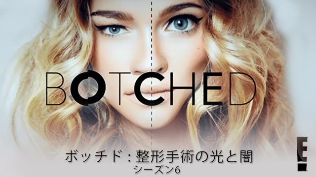 【鼻整形の失敗例まとめ】BTSになるために整形、結婚式前の極秘整形に失敗、整形後に大きくなっていく鼻…