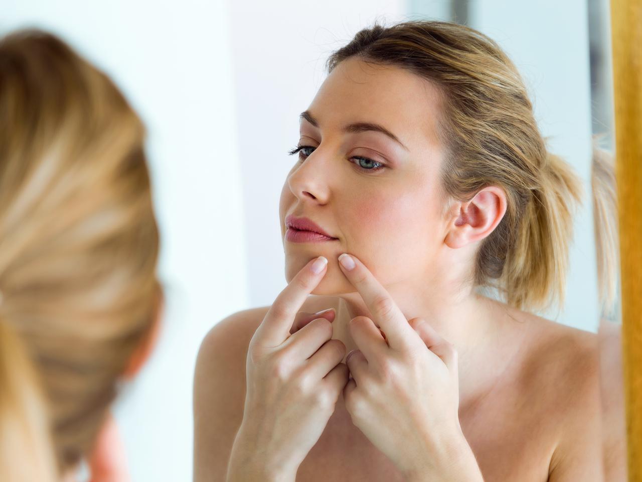 一瞬で消える!?プロの「ニキビ隠しテクニック」が目からウロコ