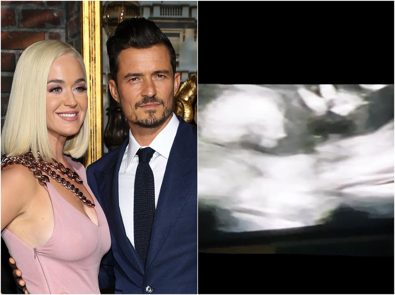 ケイティ・ペリーとオーランド・ブルームの子、“お腹の中”から『中指を立てる』様がさすがすぎる