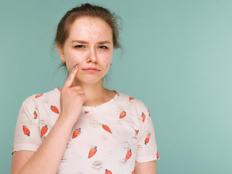 コロナ禍で「肌トラブル」が急増！肌荒れを改善する方法をプロがアドバイス