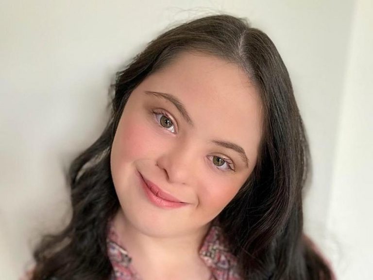 グッチが初めてダウン症のモデルを広告塔に起用する