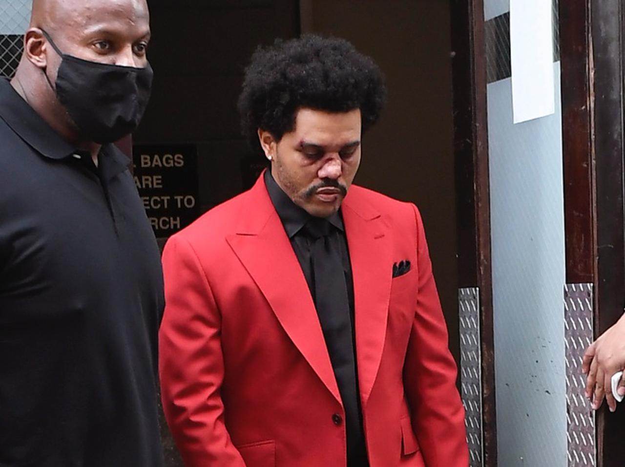 ザ・ウィークエンド、顔中傷だらけの「痛々しい姿」でリハーサルへ【VMA2020】