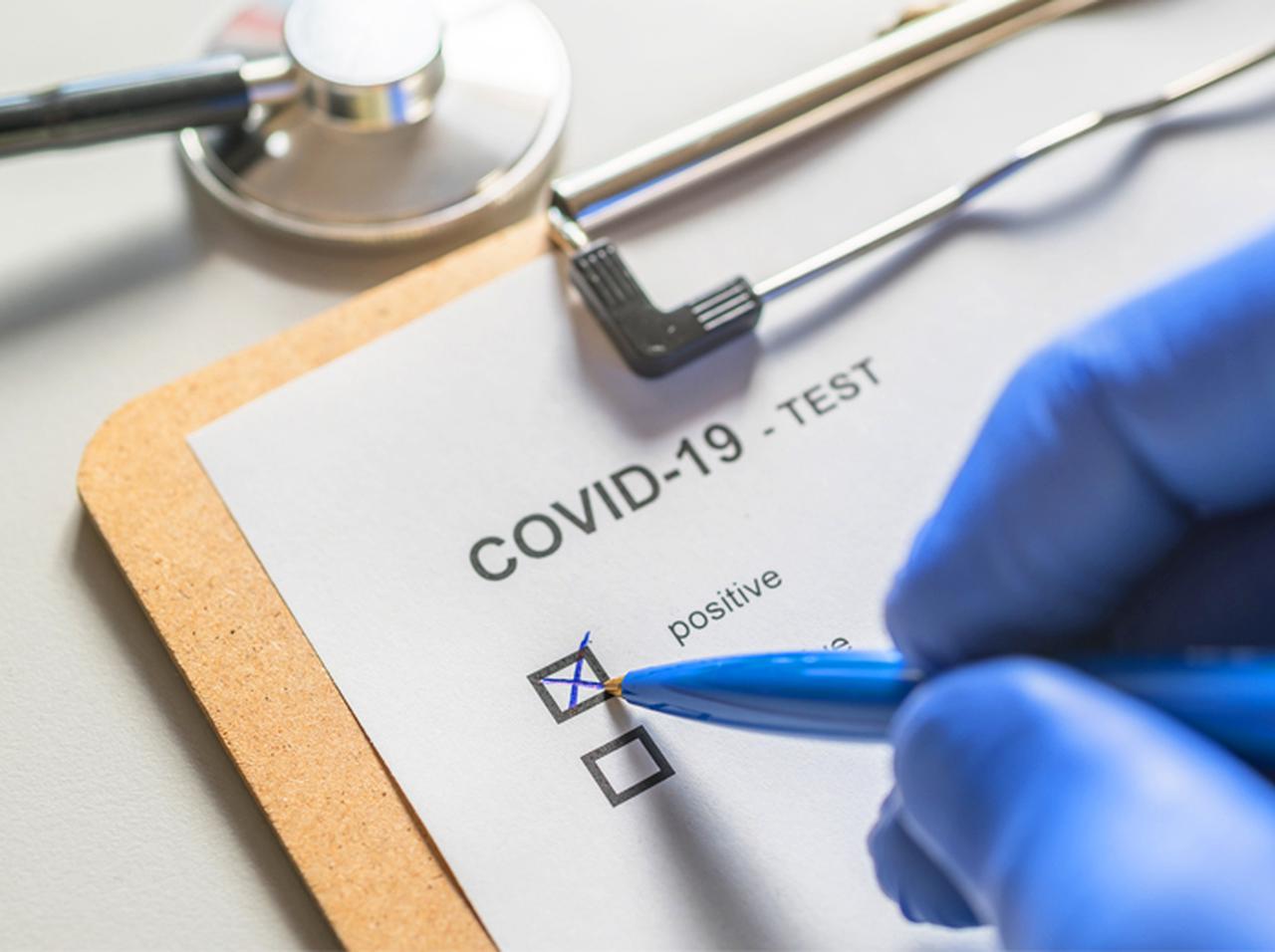 3月にコロナ罹患のコメディ俳優、当時「感染公表しなかった理由」が笑えない