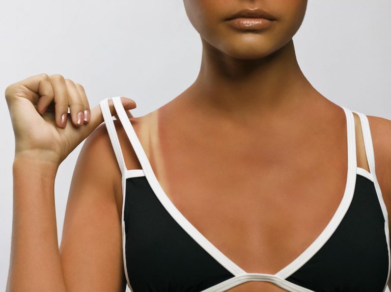 体の「日焼け跡」を薄くしたい!焼けてしまった後にやるべきボディケア