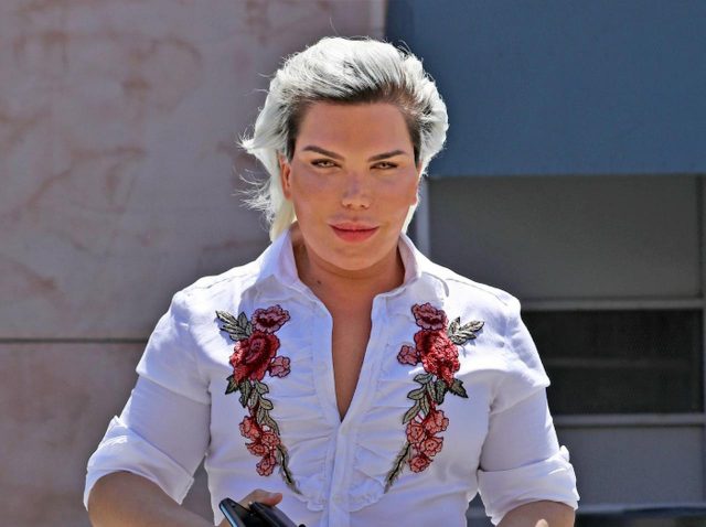 バービーの恋人ケンから「バービー」になった整形マニアの『現在』が気になる【写真アリ】