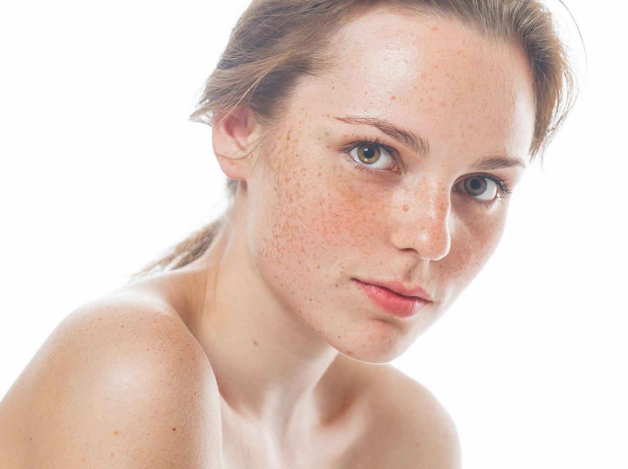 そばかすのある肌は「ファンデ」をどう選ぶべき？ぴったりの色の見つけ方
