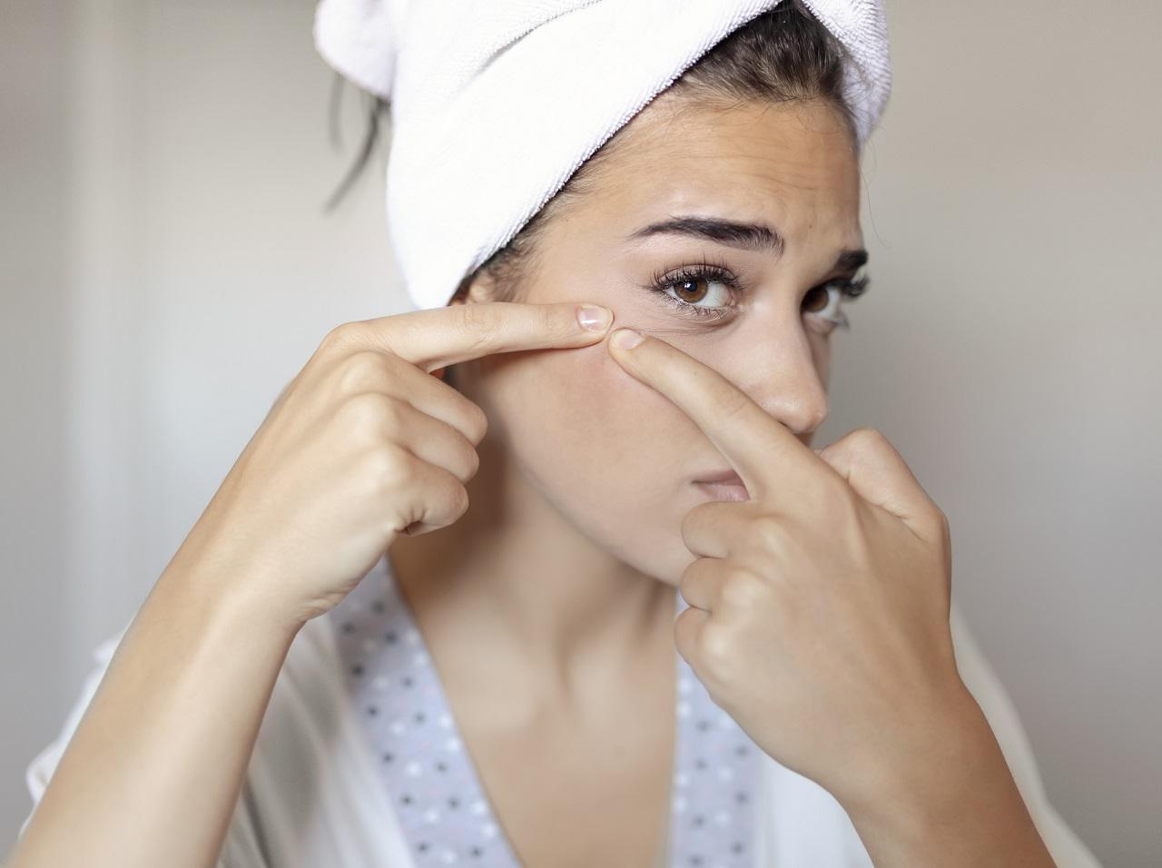 ニキビの悪化を素早く抑える!プロが勧めるアイテムとは?