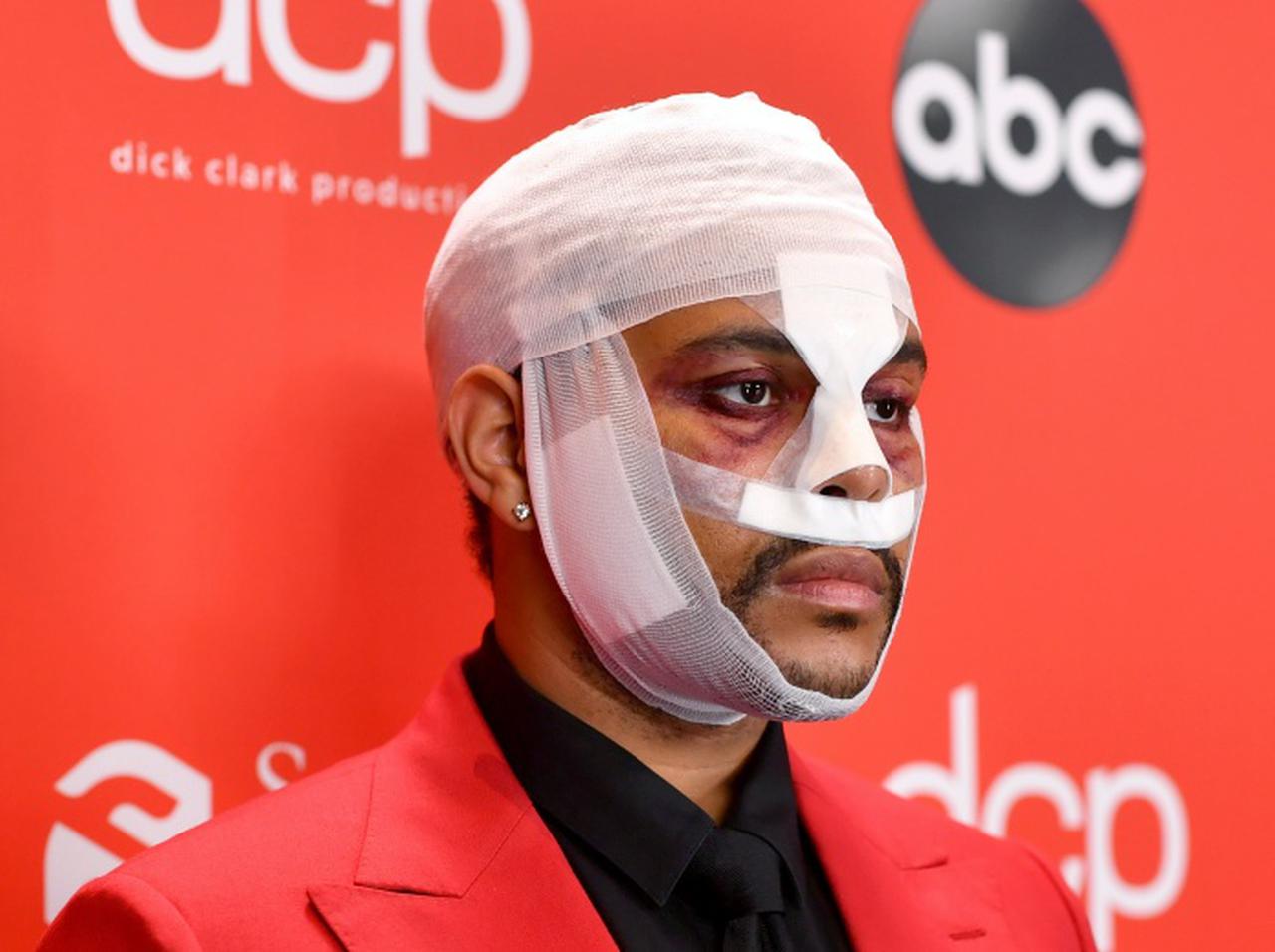 ザ・ウィークエンドが顔面大怪我⁉︎どんどん悪化する“病み系”ルックスで話題に【AMA2020】