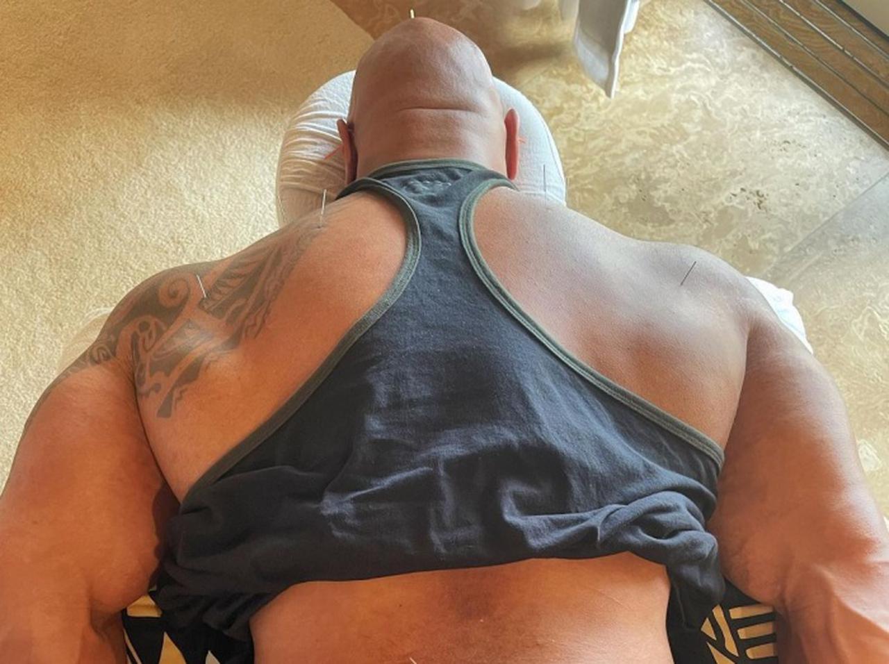 ドウェイン・ジョンソンが「鍼灸治療を受ける姿」がジワる…本人も自虐